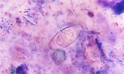 Cystoisospora belli